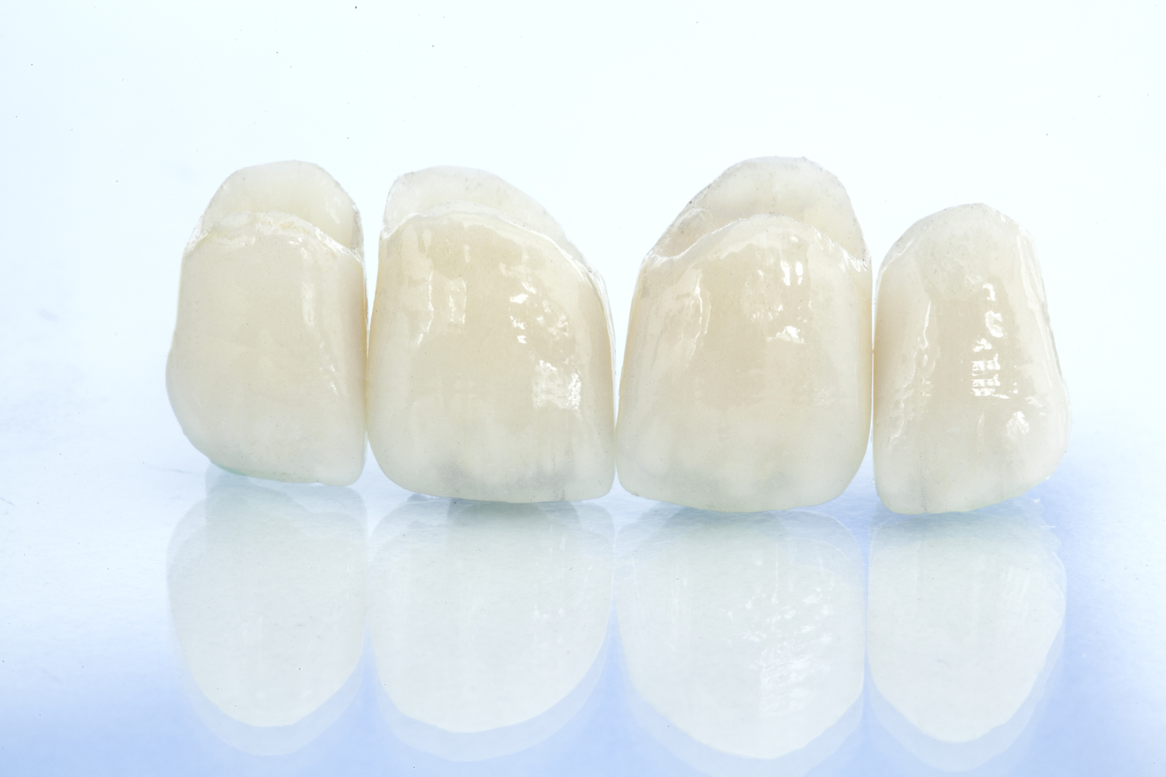 Metal free ceramic dental crowns